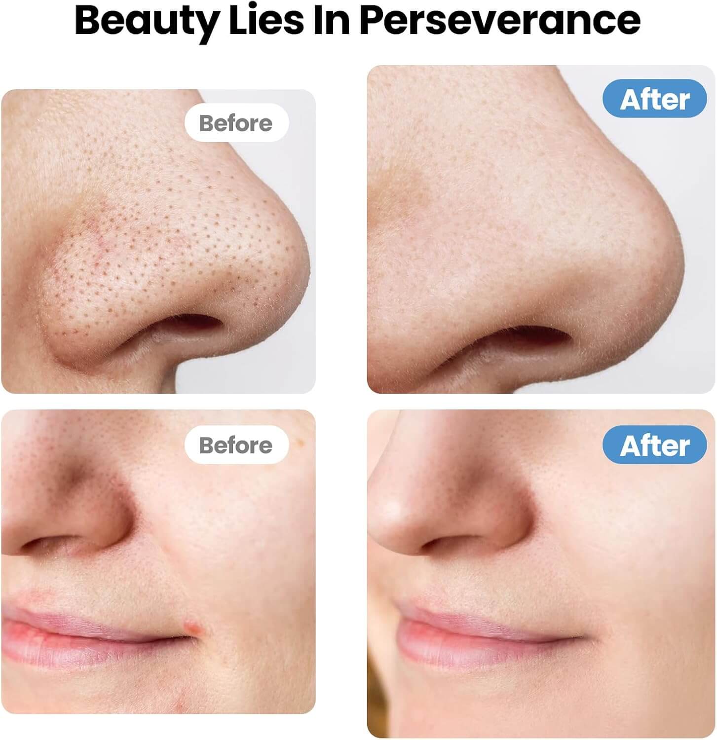 Facial Skin Scrubber | Deep Clean & Glowing Skin