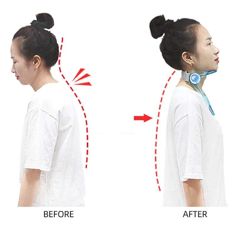 Neck Posture Corrector | Relieve Neck Pain Instantly